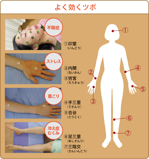 鍼灸　よく効くツボ
