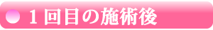 【 １回目の施術後 】