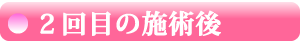 【 ２回目の施術後 】